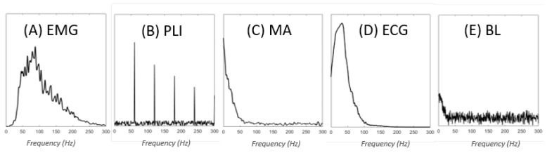 Contributors to EMG noise