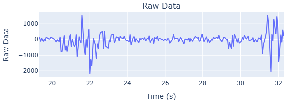 Raw data trace from SpikerBox